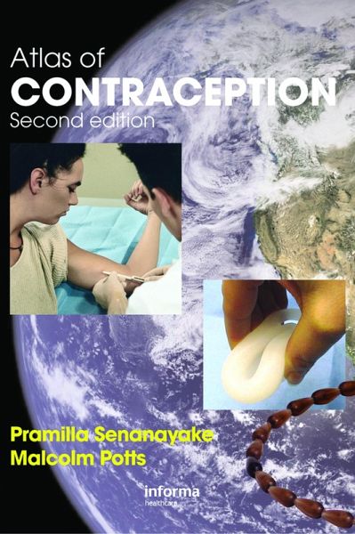 Atlas of Contraception (eBook, ePUB) Atlas of Contraception (eBook, ePUB)