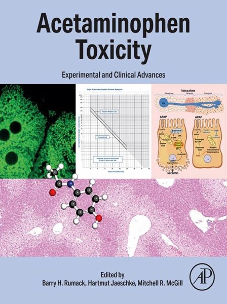 Acetaminophen Toxicity (eBook, ePUB)