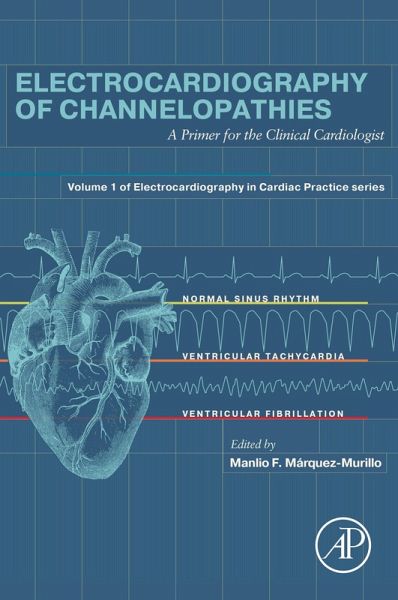 Electrocardiography of Channelopathies (eBook, ePUB)