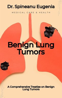 Understanding Benign Lung Tumors: A Comprehensive Guide to Non-Cancerous Pulmonary Lesions (eBook, ePUB) - Eugenia, Spineanu