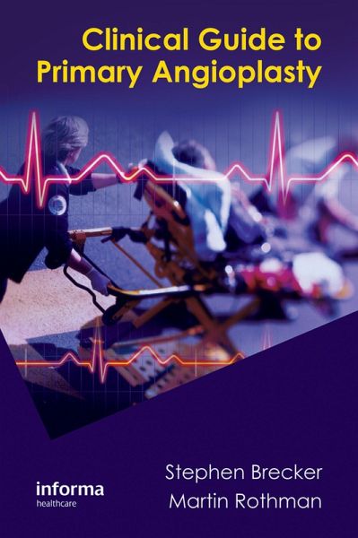 Clinical Guide to Primary Angioplasty (eBook, ePUB)