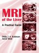 MRI of the Liver (eBook, ePUB) - Bild 1