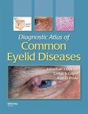 Diagnostic Atlas of Common Eyelid Diseases (eBook, ePUB) Diagnostic Atlas of Common Eyelid Diseases (eBook, ePUB)
