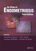 Atlas of Endometriosis (eBook, ePUB)