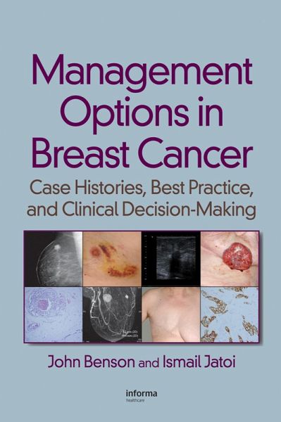 Management Options in Breast Cancer (eBook, ePUB) Management Options in Breast Cancer (eBook, ePUB)