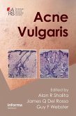 Acne Vulgaris (eBook, ePUB) Acne Vulgaris (eBook, ePUB)