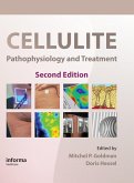 Cellulite (eBook, ePUB) Cellulite (eBook, ePUB)