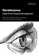 Keratoconus (eBook, ePUB) - Bild 1
