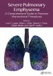Severe Pulmonary Emphysema: (eBook, PDF) - Bild 1