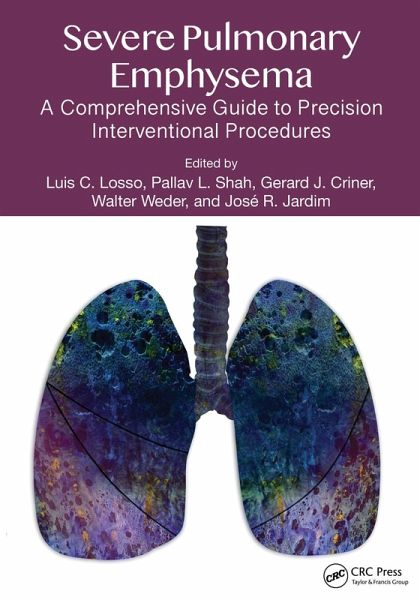 Severe Pulmonary Emphysema: (eBook, PDF)