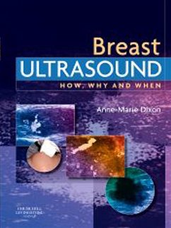 E-Book - Breast Ultrasound (eBook, ePUB) - Dixon MHSc, Pgchep