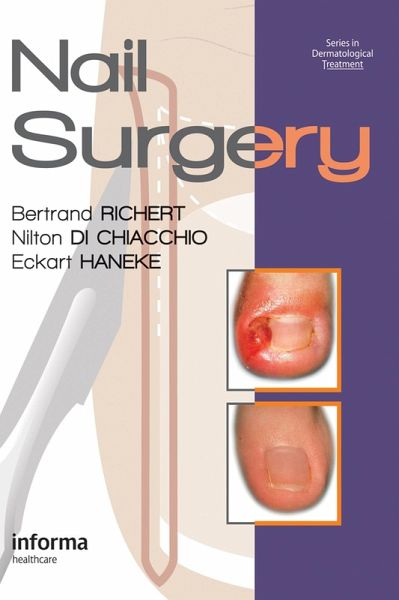 Nail Surgery (eBook, ePUB)