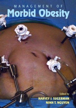 Cover Management of Morbid Obesity (eBook, ePUB)