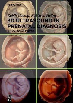 Cover 3D Ultrasound in Prenatal Diagnosis (eBook, PDF)