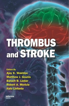 Thrombus and Stroke (eBook, ePUB)