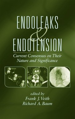 Cover Endoleaks and Endotension (eBook, ePUB)