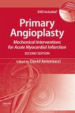 Primary Angioplasty (eBook, ePUB)