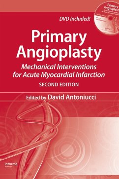Cover Primary Angioplasty (eBook, ePUB)