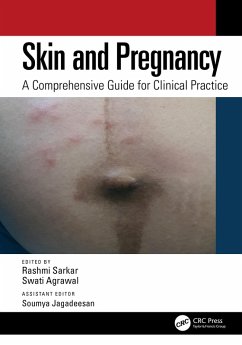 Skin and Pregnancy (eBook, PDF)