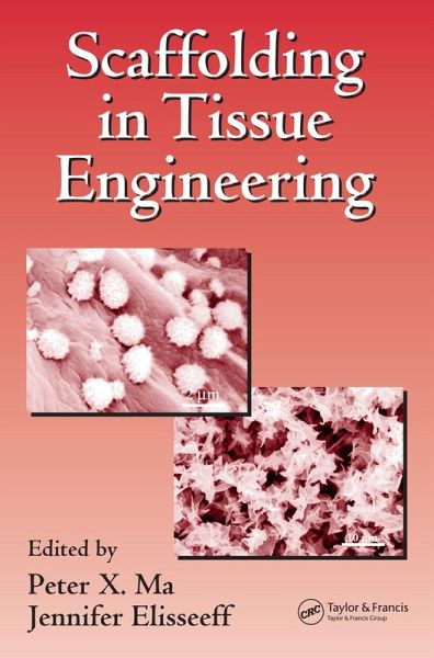 Scaffolding In Tissue Engineering (eBook, ePUB) Scaffolding In Tissue Engineering (eBook, ePUB)