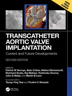 Transcatheter Aortic Valve Implantation (eBook, ePUB)