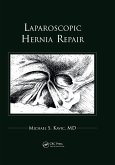 Laparoscopic Hernia Repair (eBook, ePUB)
