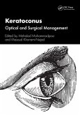 Keratoconus (eBook, PDF)