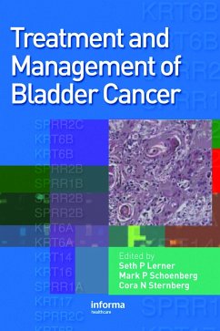 Cover Treatment and Management of Bladder Cancer (eBook, ePUB)