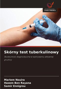 Skórny test tuberkulinowy - Nouira, Mariem;Ben Rayana, Hazem;Ennigrou, Samir