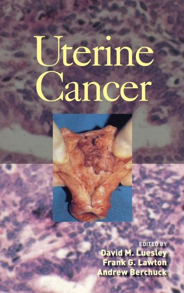 Uterine Cancer (eBook, ePUB)