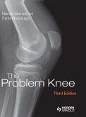 The Problem Knee (eBook, ePUB)