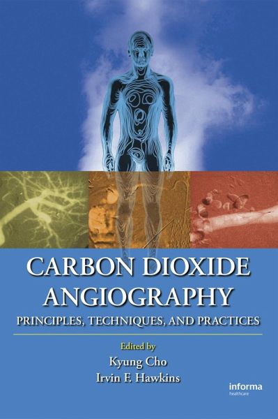 Carbon Dioxide Angiography (eBook, ePUB) Carbon Dioxide Angiography (eBook, ePUB)
