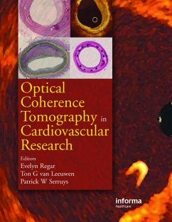 Optical Coherence Tomography in Cardiovascular Research (eBook, ePUB)