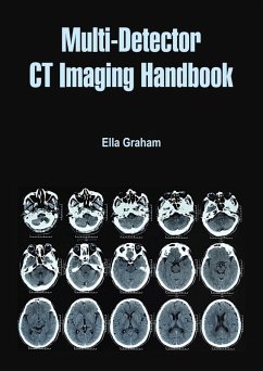 Cover Multi-Detector CT Imaging Handbook (eBook, PDF)