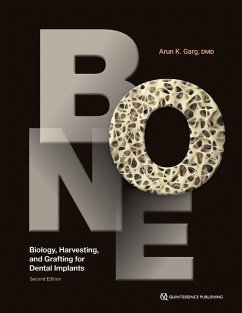 Bone (eBook, ePUB) - Garg, Arun K.