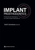 Implant Prosthodontics (eBook, ePUB)