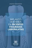 Implantes dentários em pacientes fissurados labiopalatais (eBook, ePUB)
