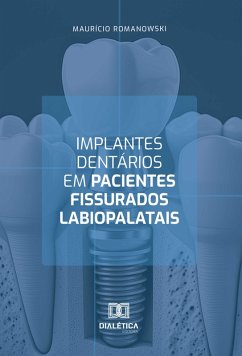 Implantes dentários em pacientes fissurados labiopalatais (eBook, ePUB) - Romanowski, Maurício