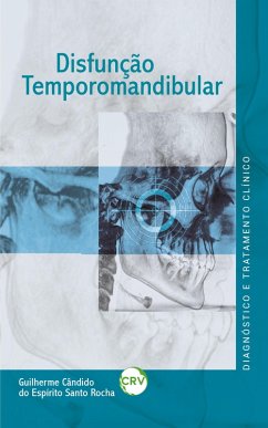 Disfunção temporomandibular (eBook, ePUB) - Rocha, Guilherme Cândido do Espírito Santo