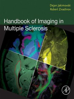 Handbook of Imaging in Multiple Sclerosis (eBook, ePUB)