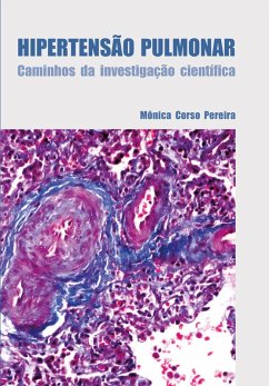 Hipertensão pulmonar (eBook, ePUB) - Pereira, Mônica Corso