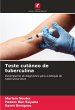 Teste cutâneo de tuberculina - Bild 1