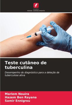 Cover Teste cutâneo de tuberculina
