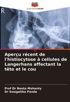 Cover Aperçu récent de l'histiocytose à cellules de Langerhans affectant la tête et le cou