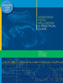 Assessing Fetal Wellbeing: A Practical Guide (eBook, ePUB) - Baker, Lesleigh S; Beaves, Mark C; Am, Euan M Wallace