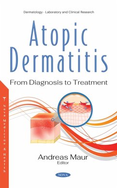 Atopic Dermatitis: From Diagnosis to Treatment (eBook, PDF)