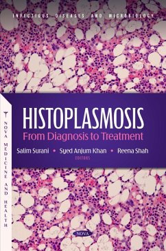Histoplasmosis: From Diagnosis to Treatment (eBook, PDF) Histoplasmosis: From Diagnosis to Treatment (eBook, PDF)