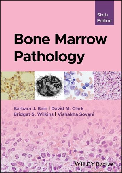 Bone Marrow Pathology (eBook, ePUB)