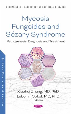 Mycosis Fungoides: Causes, Diagnosis and Treatment (eBook, PDF)