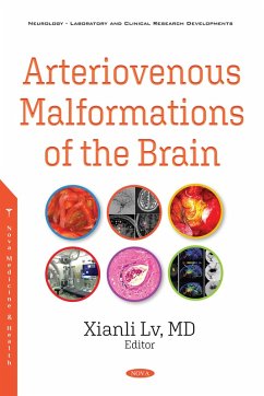 Cover Arteriovenous Malformations of the Brain (eBook, PDF)